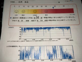 睡眠時無呼吸の検査結果